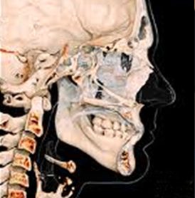 CBCT 3D 재구성 영상으로 확인한 턱뼈 상태